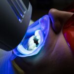 teeth whitening Lewisburg PA